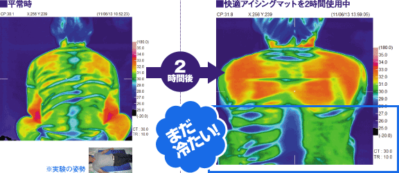 快適アイシングマットを使用したサーモグラフィ